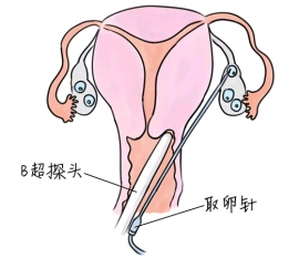 幼儿学画画，珠海捐卵宝宝学画画，学画画的好处，如何学画画