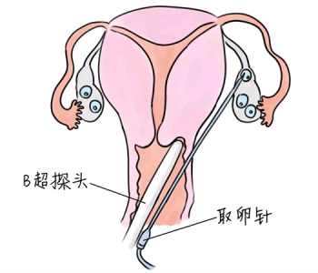 幼儿学画画，珠海捐卵宝宝学画画，学画画的好处，如何学画画